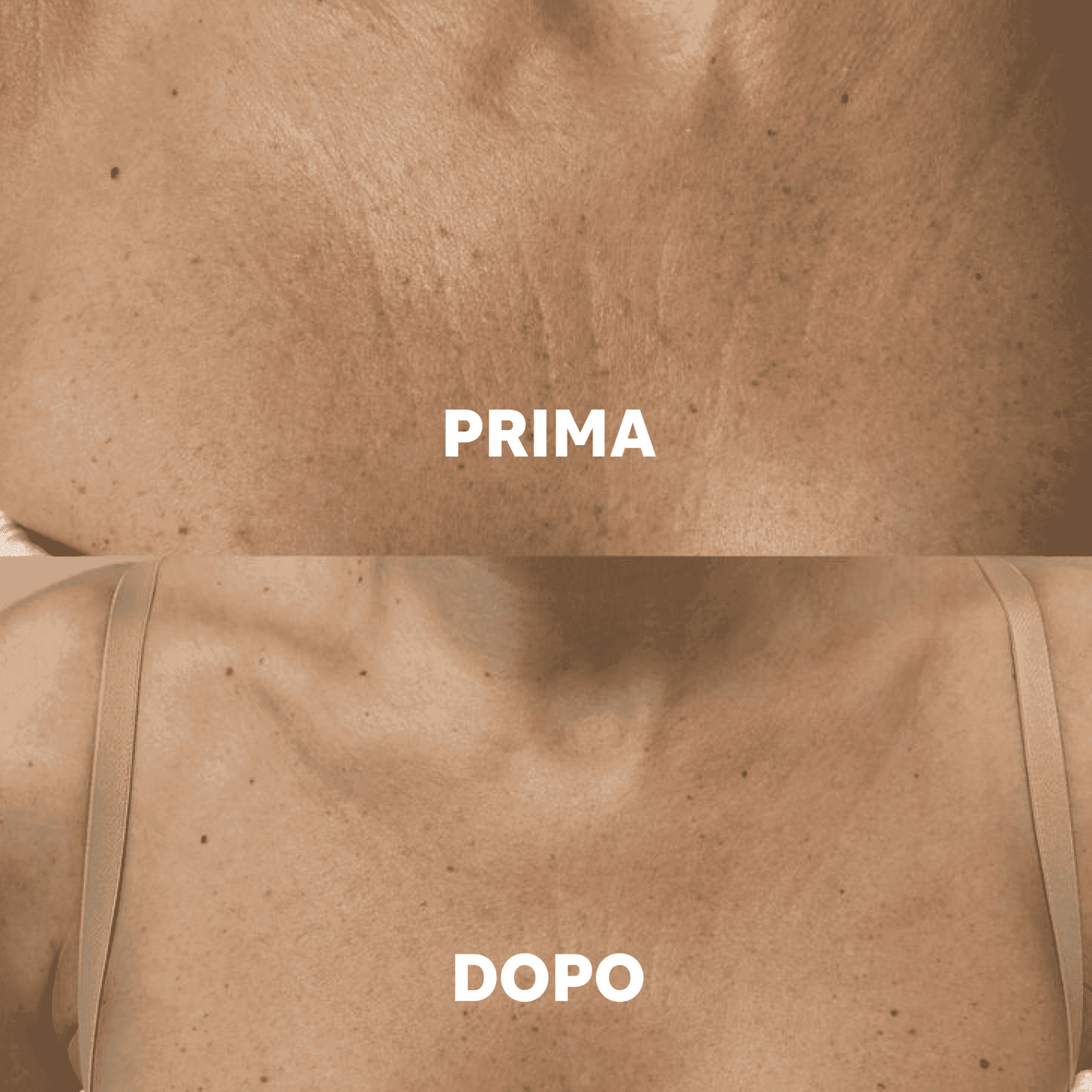 Aurealface Chest Masks