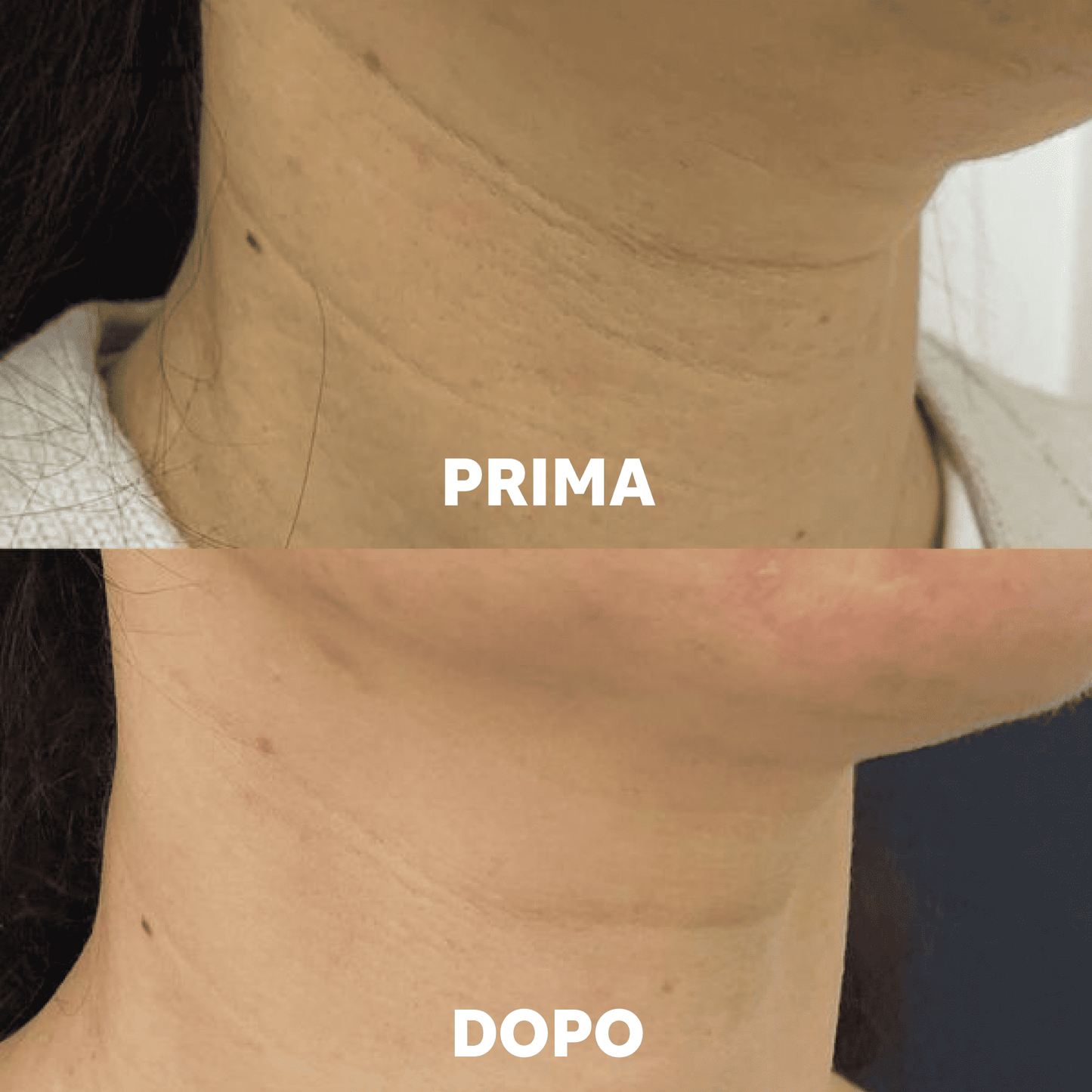 Aurealface Neck Masks
