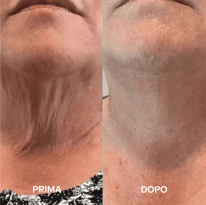 Mascarillas para cuello Aurealface™