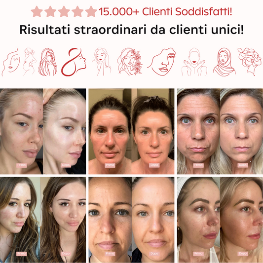 Aurealface™ Masks