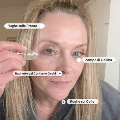 Sistema di Microinfusione Aurealface™