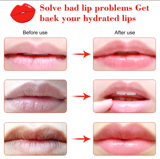 Collagen Lip Patch