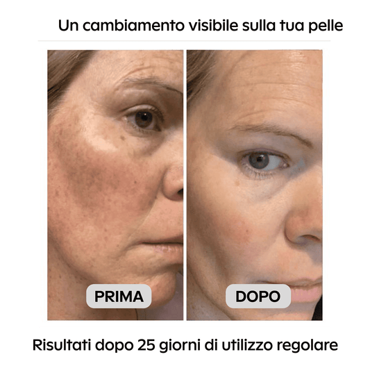 Niacinamide Serum