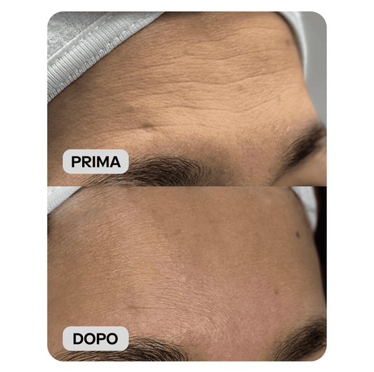 Salicylic Acid Exfoliant