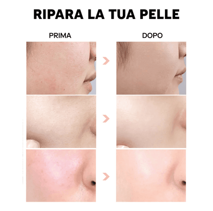 Hyaluronic Acid Serum