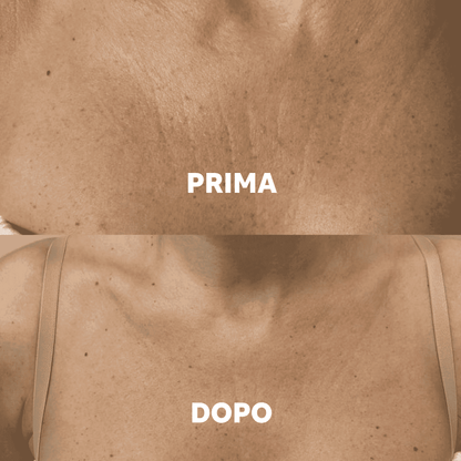 Aurealface Chest Masks