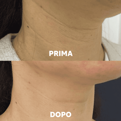 Aurealface Neck Masks